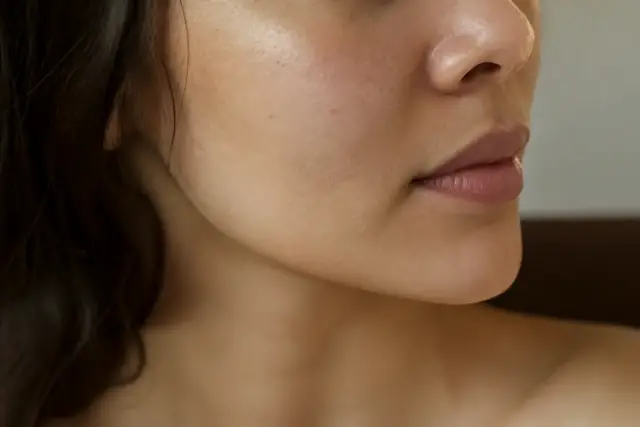 Joues et lèvre supérieure d’un visage de trois quarts, légères taches brunes diffuses, lumière douce de fenêtre
