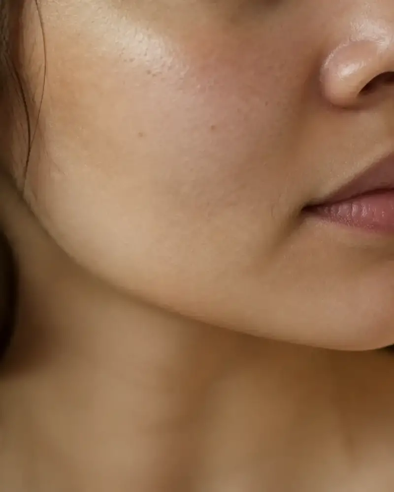 Joues et lèvre supérieure d’un visage de trois quarts, légères taches brunes diffuses, lumière douce de fenêtre